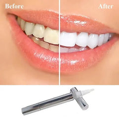 Flawless Teeth Whitening Pen Buyers Bargain Club