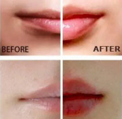 Miracle Lip Plumper Buyers Bargain Club